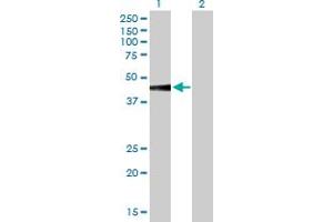 Western Blot analysis of SLC7A7 expression in transfected 293T cell line by SLC7A7 MaxPab polyclonal antibody. (SLC7A7 antibody  (AA 1-511))