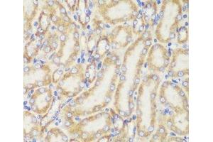 Immunohistochemistry (Paraffin-embedded Sections) (IHC (p)) image for anti-Mitochondrial Import Receptor Subunit TOM20 homolog (TOMM20) antibody (ABIN7259444)