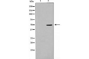 Western blot analysis on HeLa cell lysate using Thrombin Receptor Antibody,The lane on the left is treated with the antigen-specific peptide. (PAR1 antibody  (N-Term))