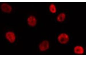 ABIN6275788 staining 293T by IF/ICC. (SUV39H2 antibody  (Internal Region))