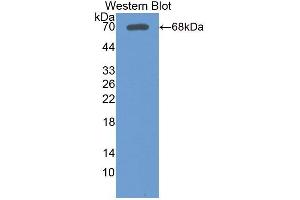 Detection of Recombinant LSR, Human using Polyclonal Antibody to Lipolysis Stimulated Lipoprotein Receptor (LSR) (LSR antibody  (AA 335-589))