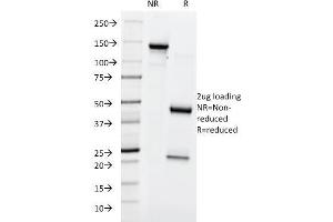 SDS-PAGE Analysis Purified Lewis Y Mouse Monoclonal Antibody (A70-A/A9). (Blood Group Lewis Y antibody)