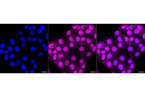 Immunocytochemical staining of HT- cells with PSMA1 antibody (ABIN7799965), 1:1,000).