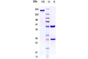 anti-CD74 (Milatuzumab Biosimilar) antibody