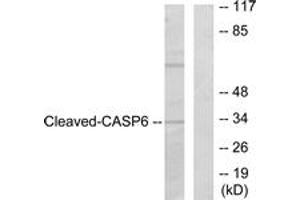Western blot analysis of extracts from 293 cells, treated with Etoposide 25uM 60', using Caspase 6 (Cleaved-Asp162) Antibody.