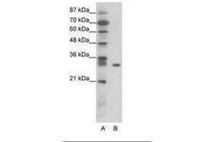Image no. 1 for anti-NF-kappa-B inhibitor beta (NFKBIB) (AA 49-98) antibody (ABIN6736066) (NFKBIB antibody  (AA 49-98))