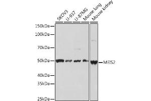 Western blot analysis of extracts of various cell lines, using MEIS2 Rabbit mAb (ABIN7268450) at 1:1000 dilution. (MEIS2 antibody)