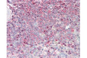 Anti-MSN / Moesin antibody IHC staining of human spleen.