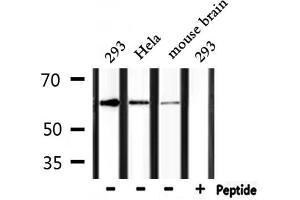 Western blot analysis of extracts from 293, Hela and mouse brain, using RANGAP1 Antibody.