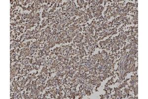 IHC analysis of ARL13B using anti-ARL13B antibody (ABIN7600179). (ARL13B antibody  (AA 16-428))