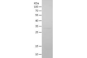 Cadherin 13 Protein (CDH13) (AA 139-381) (His tag)