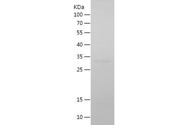 Cadherin 13 Protein (CDH13) (AA 139-381) (His tag)