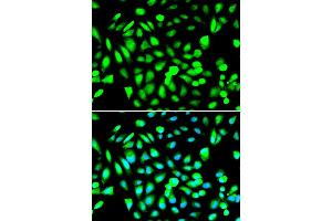 Immunofluorescence analysis of A549 cell using PRMT5 antibody. (PRMT5 antibody)