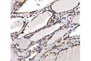 anti-Interferon, gamma-Inducible Protein 16 (IFI16) (AA 183-743) antibody