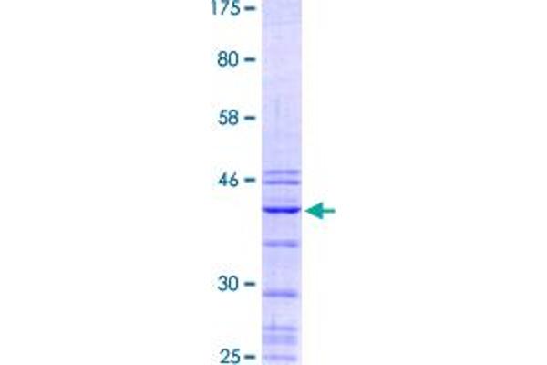 TTF1 Protein (AA 1-99) (GST tag)