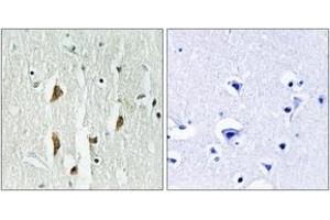 Immunohistochemistry analysis of paraffin-embedded human brain tissue, using PAK1/2/3 (Ab-423/402/421) Antibody. (PAK1/2/3 antibody  (AA 391-440))
