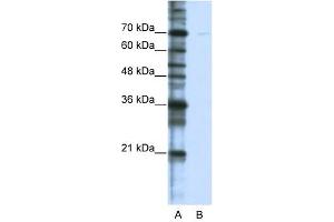 CSTF2T antibody used at 0. (CSTF2T antibody  (C-Term))