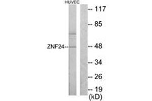 Western blot analysis of extracts from HuvEc cells, using ZNF24 Antibody. (ZNF24 antibody  (AA 10-59))