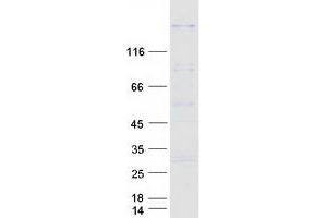 Validation with Western Blot