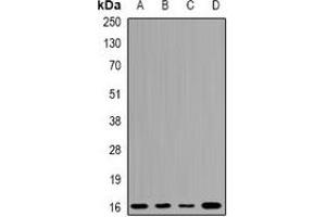 Western blot analysis of UBCH7 expression in A549 (A), K562 (B), mouse testis (C), mouse brain (D) whole cell lysates.