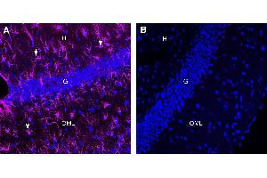 Comparison of immunostaining with Anti-GFAP antibody to immunostaining with isotype control in rat hippocampusImmunohistochemical staining of perfusion-fixed frozen rat brain sections with Anti-GFAP-ATTO Fluor-647N Antibody (ABIN7582030), (1:80). (Rabbit IgG isotype control (Atto 647N))