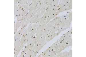 Immunohistochemistry of paraffin-embedded rat heart using SNRPA Antibody (ABIN5973811) at dilution of 1/100 (40x lens). (SNRPA1 antibody)