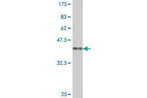 Western Blot detection against Immunogen (38. (GRK4 antibody  (AA 36-145))