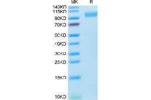 Human ACE2 on Tris-Bis PAGE under reduced condition. (ACE2 Protein (AA 18-740) (His tag))