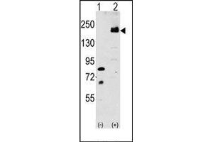Image no. 1 for anti-Low Density Lipoprotein Receptor-Related Protein 6 (LRP6) (C-Term) antibody (ABIN358636) (LRP6 antibody  (C-Term))