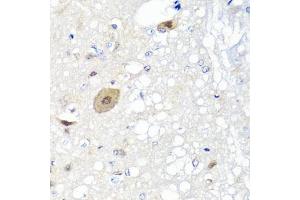 Immunohistochemistry of paraffin-embedded rat brain using FGF13 antibody (ABIN5975664) at dilution of 1/100 (40x lens). (FGF13 antibody)