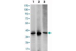 Western blot analysis using MAP2K6 monoclonal antibody, clone 3H12C8  against HepG2 (1), MCF-7 (2) and NIH/3T3 (3) cell lysate. (MAP2K6 antibody)