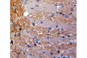 Used in DAB staining on fromalin fixed paraffin-embedded Brain tissue (SCGB3A1 antibody  (AA 21-104))