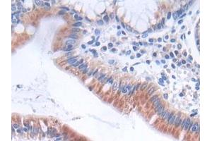 Immunohistochemistry (IHC) image for anti-Glycolipid Transfer Protein (GLTP) (AA 2-209) antibody (ABIN7443623)