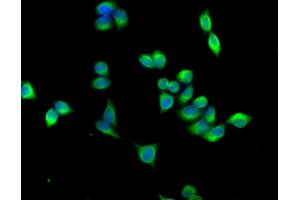 Immunofluorescence staining of PC-3 cells with ABIN7143044 at 1:166,counter-stained with DAPI. (ABLIM3 antibody  (AA 266-544))