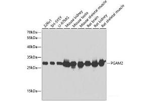 Western blot analysis of extracts of various cell lines using PGAM2 Polyclonal Antibody at dilution of 1:1000. (PGAM2 antibody)