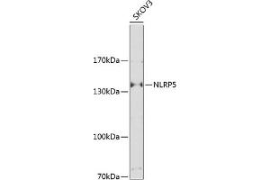 Western blot analysis of extracts of SKOV3 cells, using NLRP5 Antibody (ABIN6131482, ABIN6144667, ABIN6144668 and ABIN6225229) at 1:1000 dilution. (NLRP5 antibody  (AA 157-256))