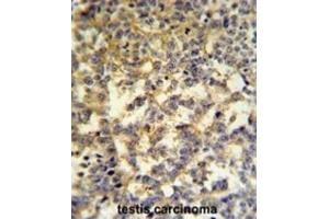 Immunohistochemistry (IHC) image for anti-Glucose-6-Phosphate Dehydrogenase (G6PD) antibody (ABIN3002234)