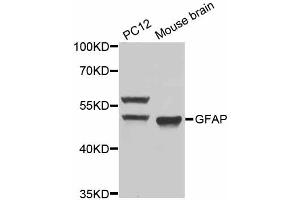 Western blot analysis of extracts of various cell lines, using GFAP antibody (ABIN5970067) at 1/1000 dilution. (GFAP antibody)