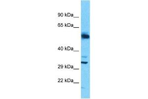 Host:  Rabbit  Target Name:  SLC25A30  Sample Type:  Uterus Tumor lysates  Antibody Dilution:  1. (SLC25A30 antibody  (N-Term))