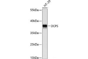 Western blot analysis of extracts of HT-29 cells using DCPS Polyclonal Antibody at dilution of 1:1000. (DCPS antibody)