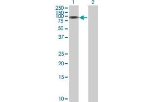 Western Blotting (WB) image for anti-Serpin Peptidase Inhibitor, Clade G (C1 Inhibitor), Member 1 (SERPING1) (AA 1-500) antibody (ABIN513844)