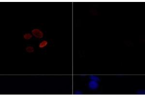 Immunofluorescence analysis of C6 cells treated by TSA (upper left) and untreated C6 cells (upper right) using Acetyl-Histone H4-K16 Polyclonal Antibody at dilution of 1:100. (Histone H4 antibody  (acLys16))