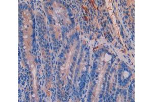IHC-P analysis of Kidney tissue, with DAB staining. (UMPS antibody  (AA 311-481))