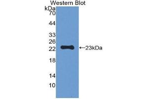 Western Blotting (WB) image for anti-Peroxiredoxin 1 (PRDX1) (AA 1-199) antibody (Biotin) (ABIN1175813) (Peroxiredoxin 1 antibody  (AA 1-199) (Biotin))