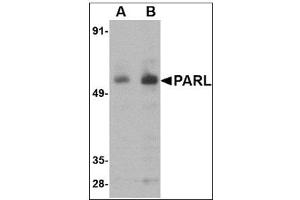 Western blot analysis of PARL in 3T3 cell lysate with PARL antibody at (A) 1 and (B) 2 µg/ml. (PARL antibody  (N-Term))