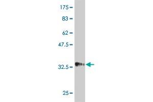 Western Blot detection against Immunogen (34. (HAND2 antibody  (AA 135-216))