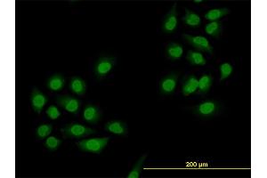 Immunofluorescence of monoclonal antibody to SMAD4 on HeLa cell. (SMAD4 antibody  (AA 1-552))