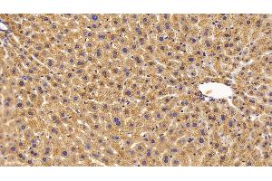Immunohistochemistry (IHC) image for anti-Catalase (CAT) (AA 401-523) antibody (ABIN7434887)