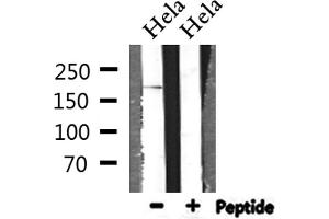 Western blot analysis of extracts from Hela, using BCOR Antibody. (BCOR antibody  (Internal Region))