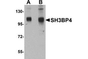 Western Blotting (WB) image for anti-SH3-Domain Binding Protein 4 (SH3BP4) (C-Term) antibody (ABIN1030656)